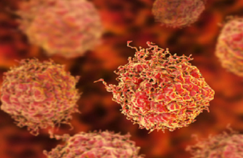 اكتشاف علاج واعد لأحد أخطر أنواع سرطان الدم