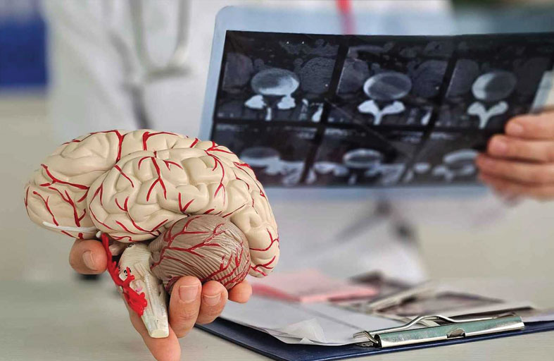 دواء جديد يمنح الأمل لمرضى الزهايمر المبكر