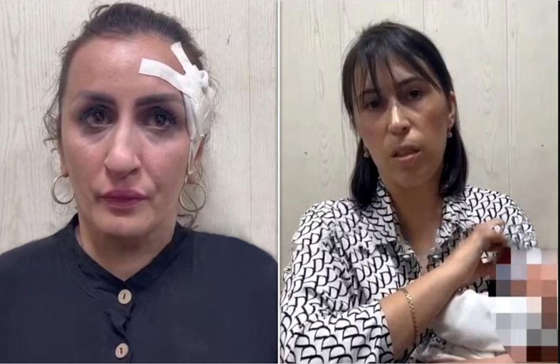 باعت طفلها من أجل عملية  تجميل لأنفها