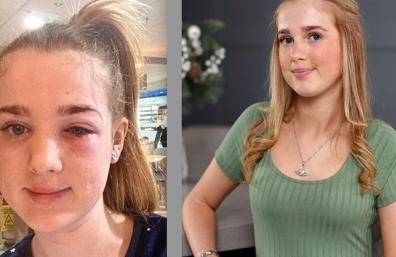 تكاد تصاب بالعمى بسبب مقطع على تيك توك