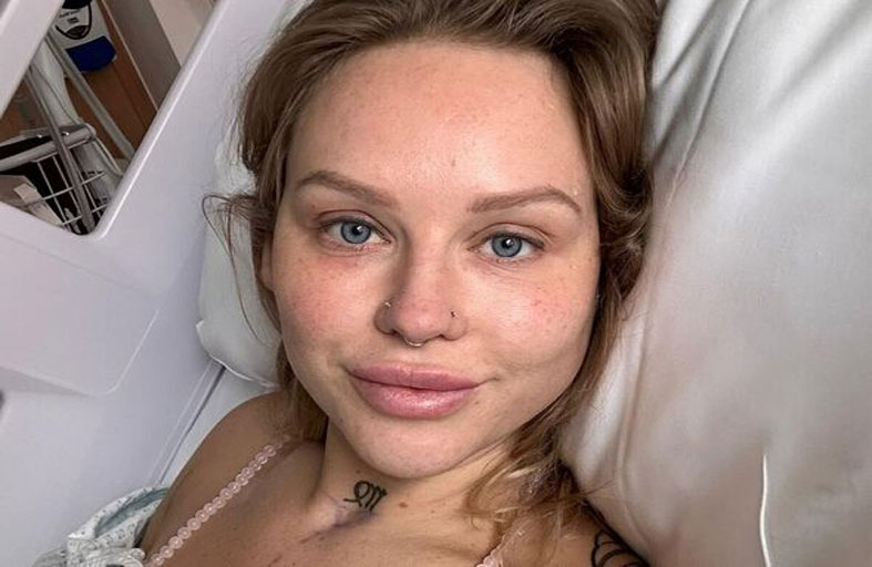 تصاب بالعمى بسبب عملية تكبير ثدي