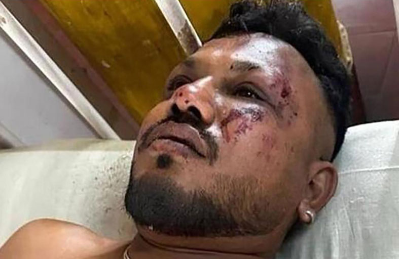 الناجي الوحيد من الطائرة المنكوبة يروي تفاصيل نجاته 