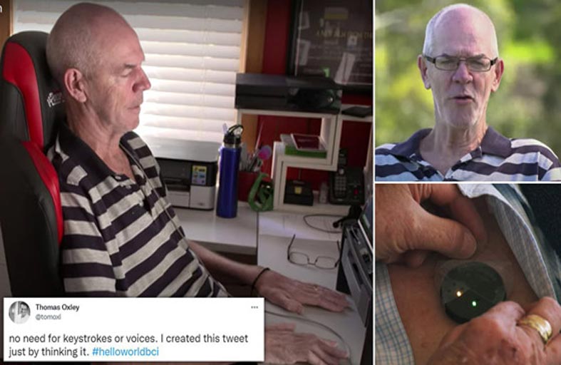 رجل مشلول يرسل تغريدة باستخدام دماغه