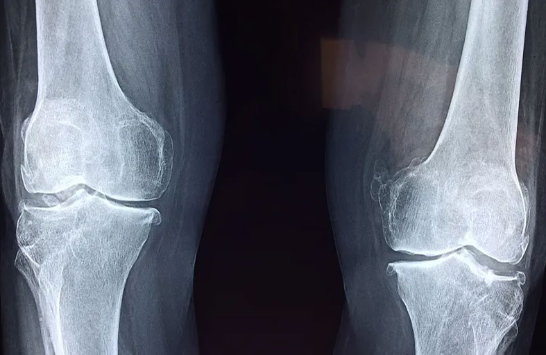 دراسة تفضل رياضة كرة القدم على الجري