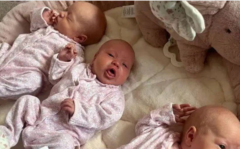 ولادة نادرة تحدث مرة كل 200 مليون حالة