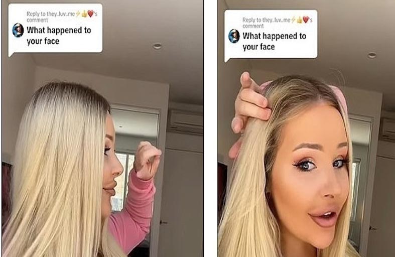 تتحول إلى باربي حقيقية بفضل عملية تجميل ناجحة