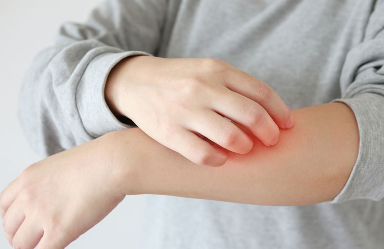 احذر الحكة بعد الاستحمام.. قد تكون أكثر من مجرد جفاف في الجلد!