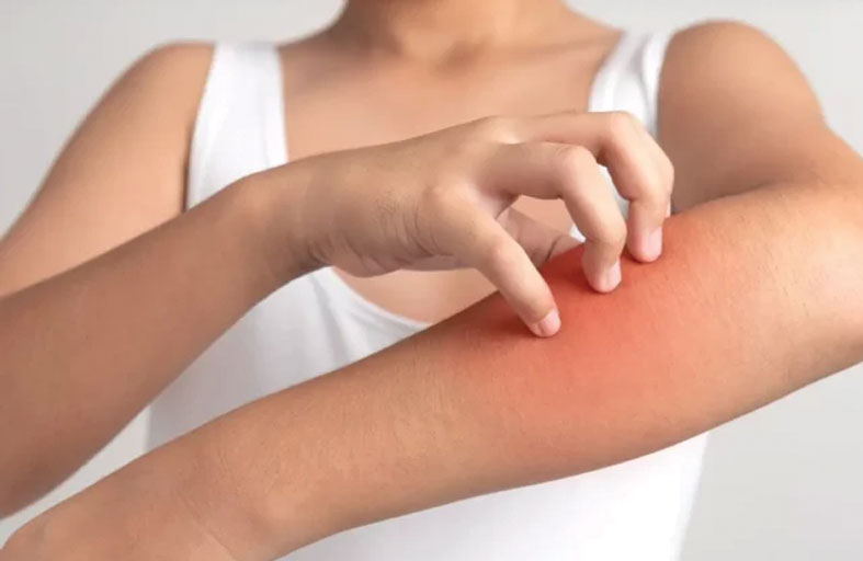 التوتر النفسي يزيد من حساسية الجلد 