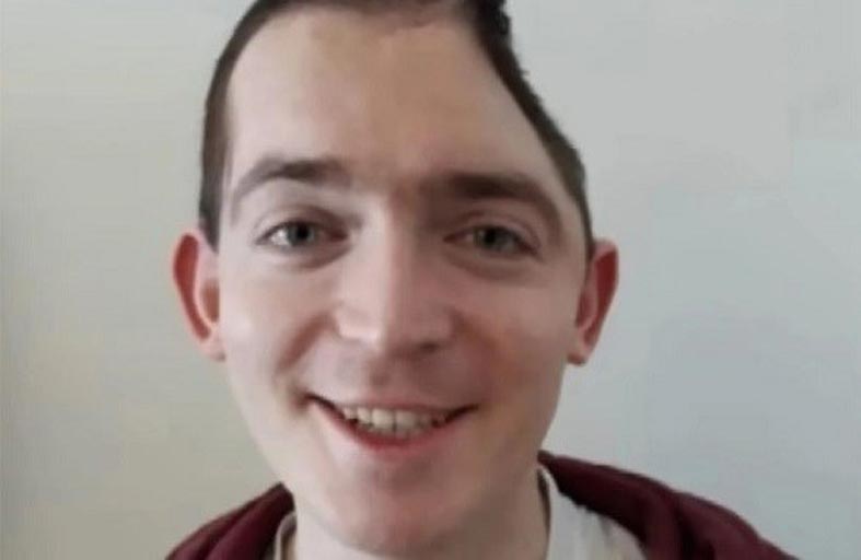 يقاضي شركته بعدما فقد جزءاً من رأسه