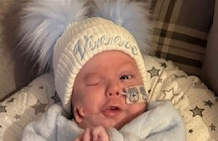 رضيع بتشوهات نادرة.. أذن على خدّه وعين فارغة