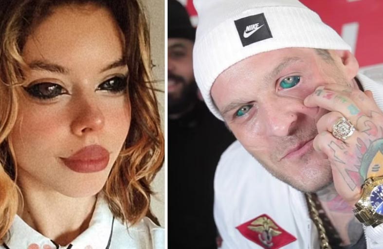 أرادت تقليد مغن شهير.. ففقدت بصرها