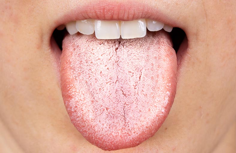 الشعر على اللسان.. حالة مخيفة تصيب رجلا 