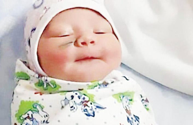 جرح في وجه مولودة.. والطبيب يلومها 