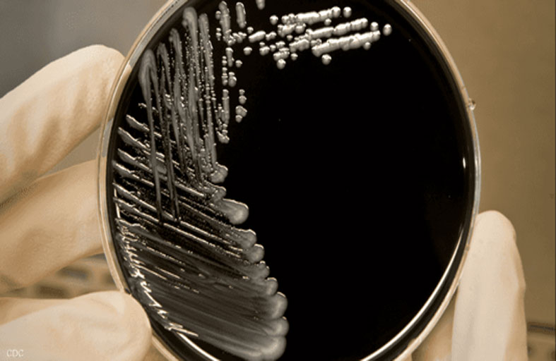 واقعة الحديقة تحول حياة امرأة إلى مأساة