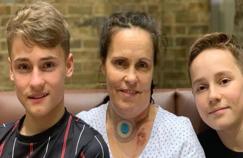 إعادة بناء لسان مريضة بالسرطان بأنسجة ساقها