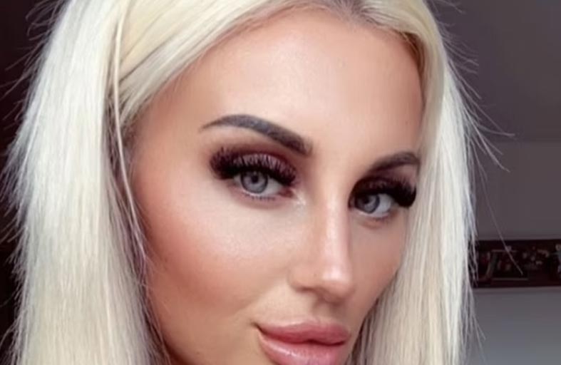 مدمنة على «الفيلر » تصاب بتضخم خطير