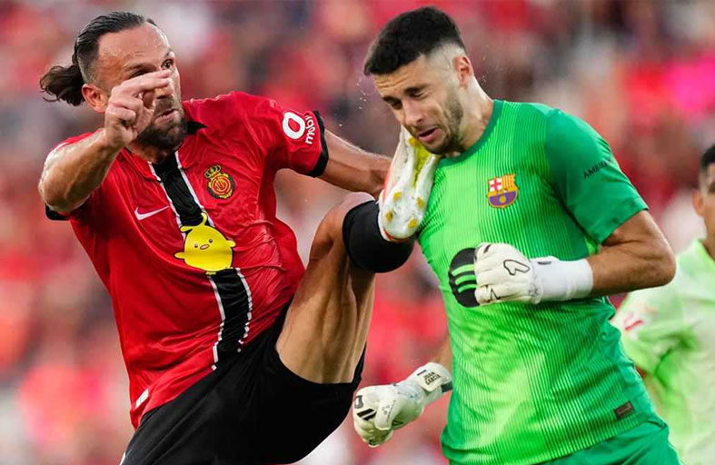 وجه متورم.. آثار التدخل العنيف تظهر على حارس برشلونة 