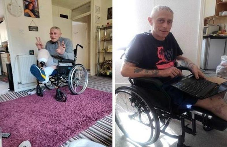 بتر ساقي رجل نجا بأعجوبة من السياج