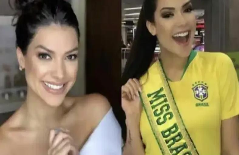 جراحة بسيطة تقتل ملكة جمال البرازيل