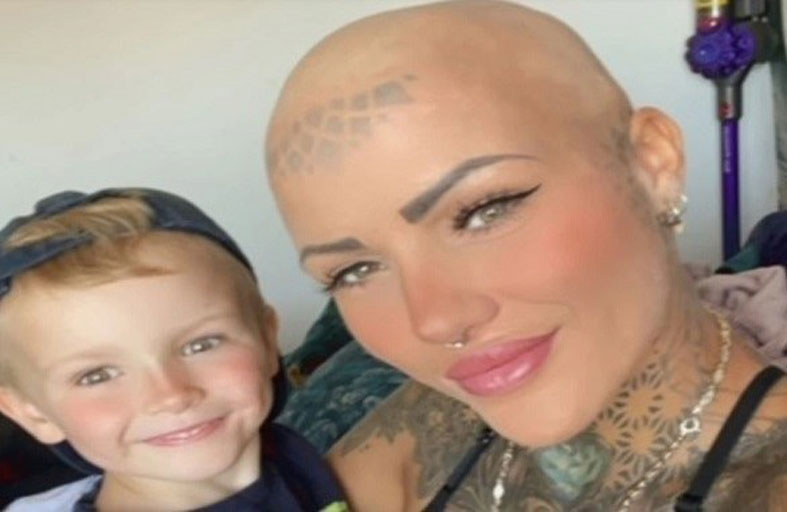 تكتشف إصابتها بالسرطان بعد عملية تجميل