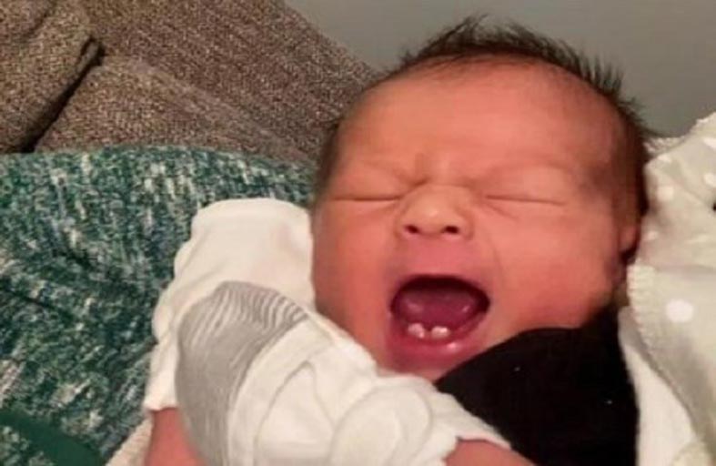 طفل يولد بأسنان يثير الدهشة 