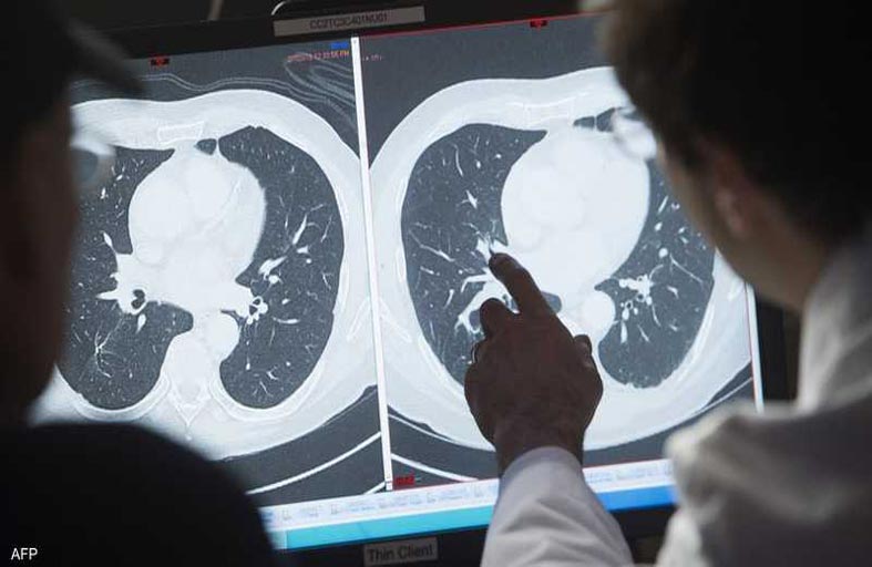 أمل جديد.. علاج فعال  لسرطان البروستاتا