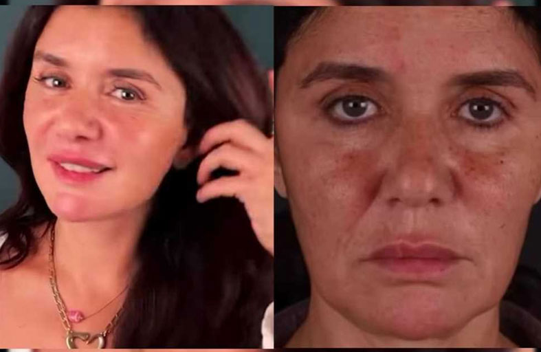 غادة عادل تفاجئ جمهورها: أجريت عملية تجميل والنتيجة مذهلة!