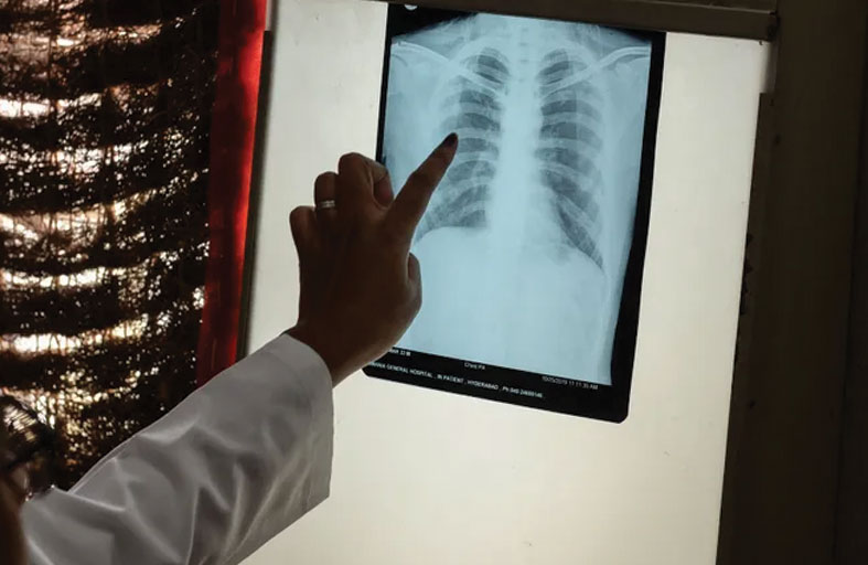 دراسة مفزعة.. هذا مقدار ما تلتهمه سيجارة واحدة من عمرك