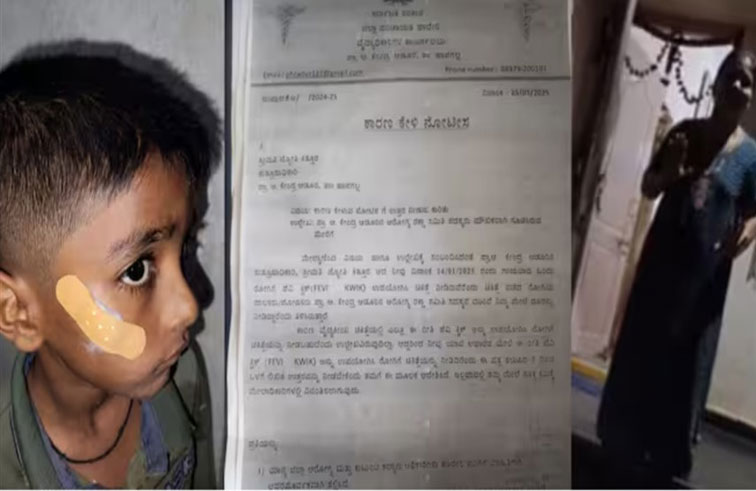 توقيف ممرضة ألصقت جروح طفل بالغراء بدل خياطتها