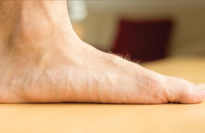 تظهر على القدمين.. علامات تنذر بوجود مشاكل صحية خطيرة