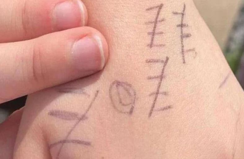 رموز غامضة على جسد طفل 