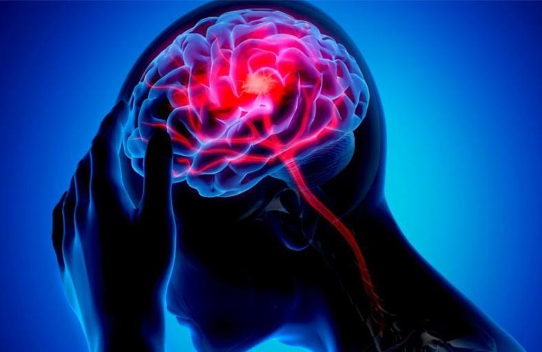 دراسة تكشف أسرارا مثيرة بشأن أدمغة الناطقين بالعربية