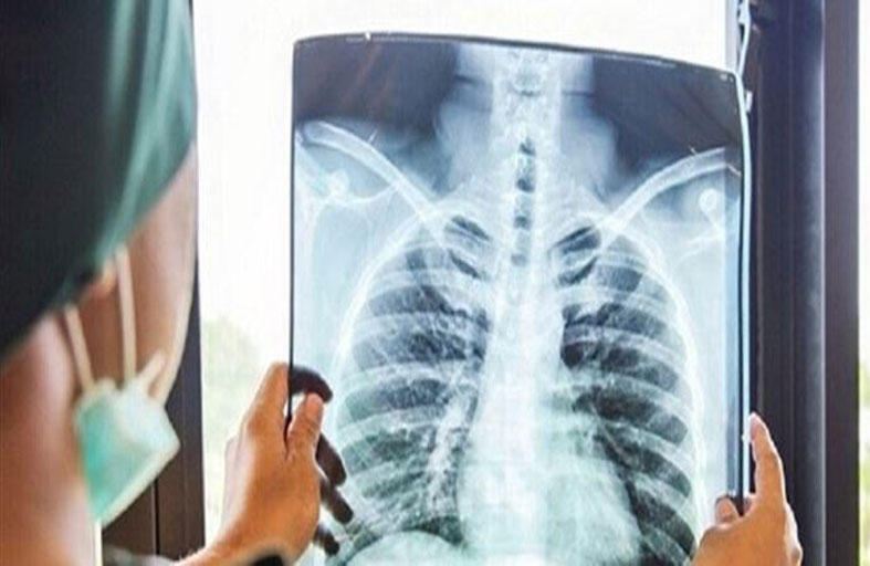 أمل جديد.. دراسة تبشر بحماية الرئتين من التلف القاتل