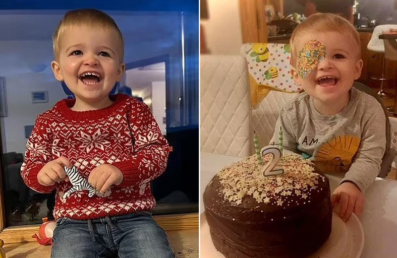 تكتشف إصابة طفلها بسرطان العين بالصدفة