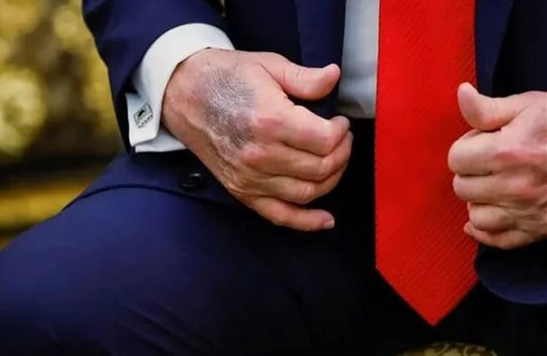 ترامب يتجاهل التكهنات حول صحته