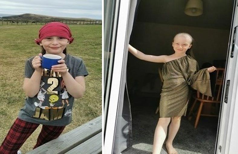 التوتر يصيب فتاة بالصلع