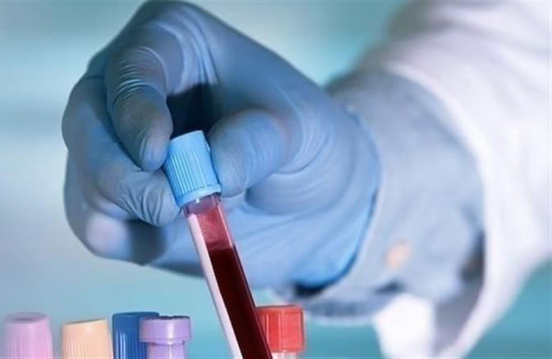 اختبار دم ثوري يتنبأ بعودة سرطان الثدي