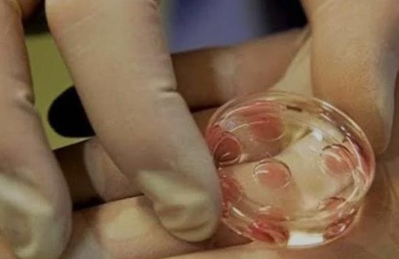 تجميد البويضات.. تقنية تشهد إقبالا متزايدا في لبنان