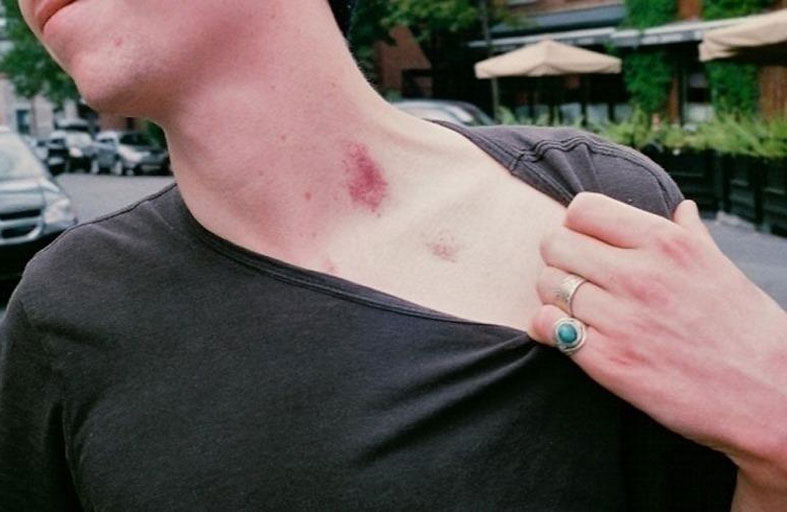 شاب يفارق الحياة بسبب قبلة