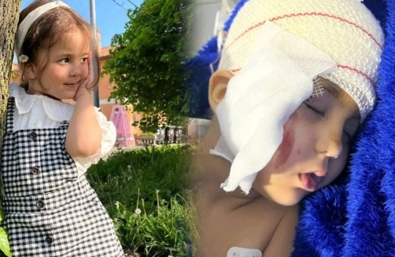 دهس طفلة يتحول إلى قضية رأي عام في المغرب