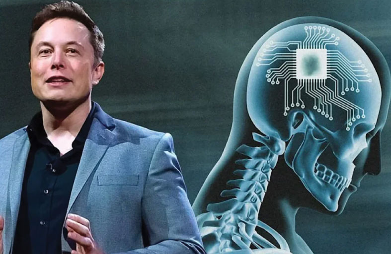 نجاح زرع شريحة دماغية في أول إنسان