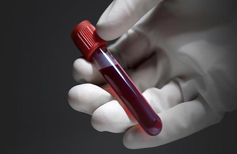 استبدلت دم ابنها بعينة من دمها.. لتبرئته!