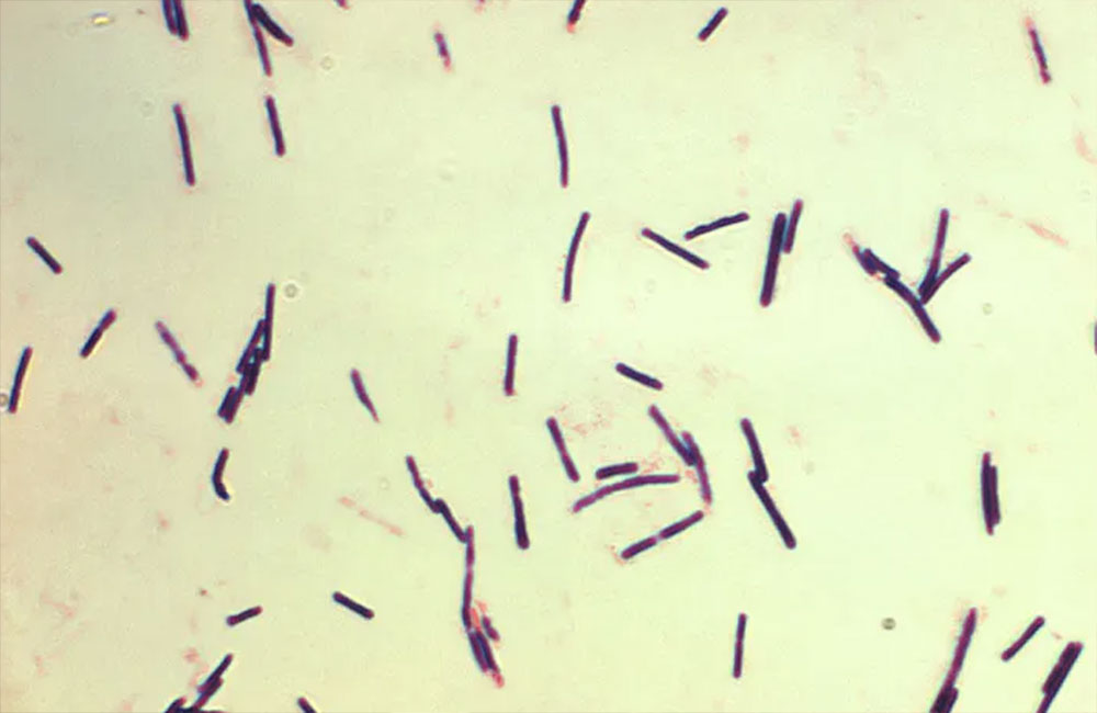 مرض غامض في بلد إفريقي يقتل 7 ويصيب العشرات