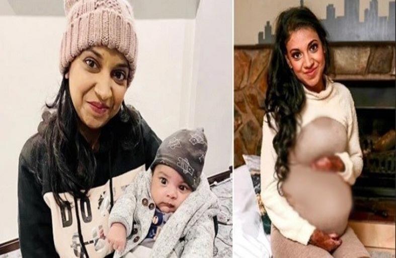 تصاب بحروق أثناء المخاض بسبب حالة نادرة