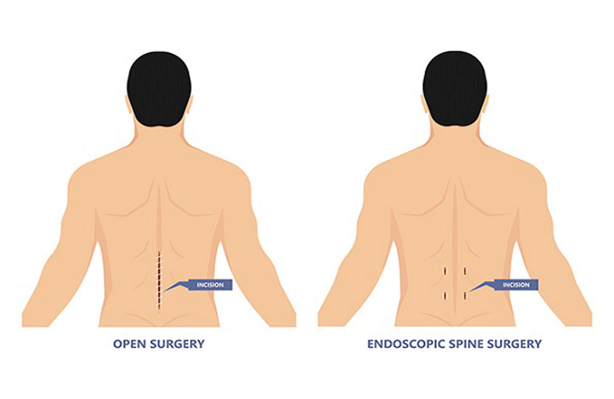 مستشفى الجامعة بالشارقة يُدخل الجراحة بالمنظار في مركز هيمشان لجراحة العمود الفقري والمفاصل