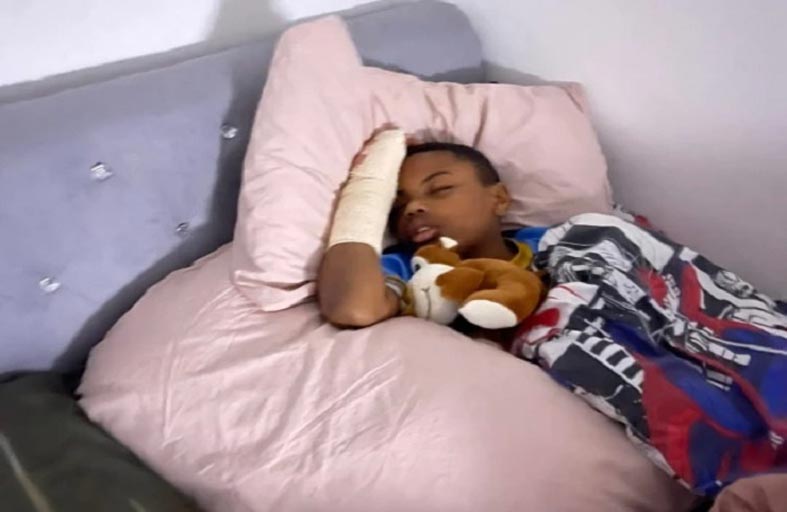 التنمر يتسبب بقطع إصبع طفل في مدرسة