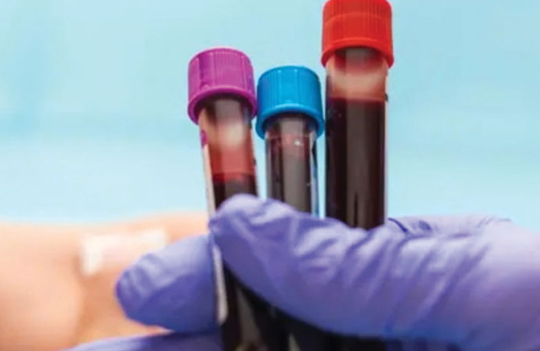 اختبار دم يشخّص أخطر الاضطرابات الوراثية لدى الأطفال خلال أيام