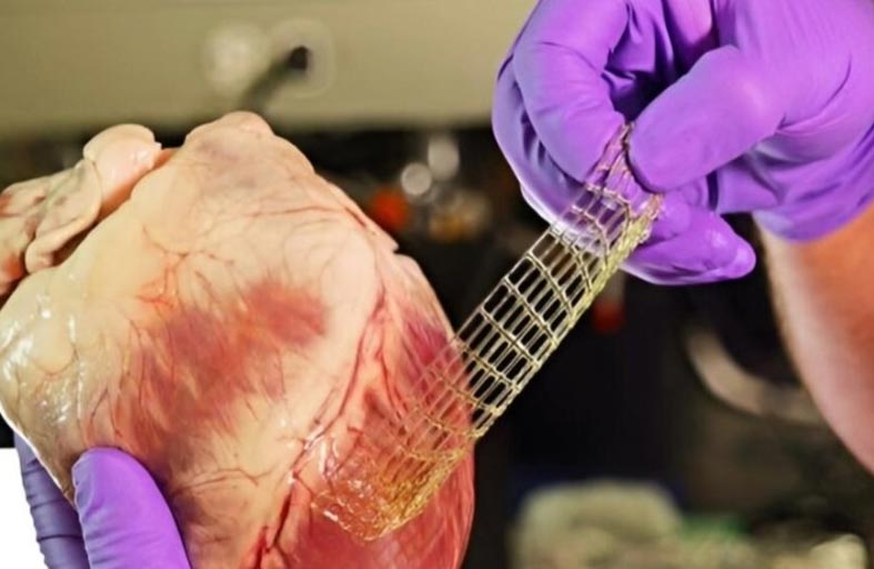 طباعة ثلاثية الأبعاد جديدة لإصلاح الأنسجة التالفة في القلب