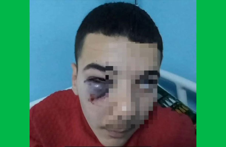 معلم يضرب طالباً بكرسي حديد في وجهه