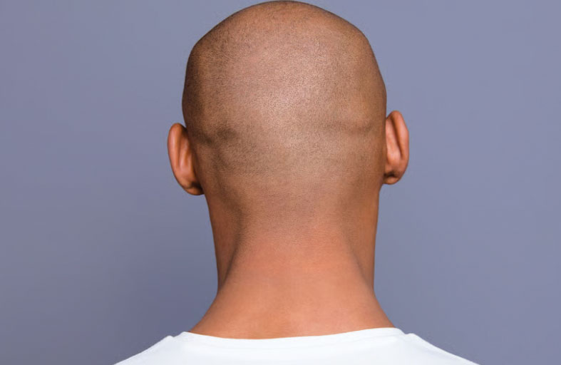 رجال صُلع يتسببون بالقبض على صاحب صالون حلاقة